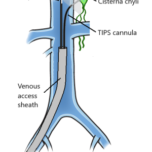 drawing of lymph system
